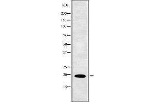 Image no. 1 for anti-Protein Phosphatase 3, Regulatory Subunit B, alpha (PPP3R1) (Internal Region) antibody (ABIN6264396)