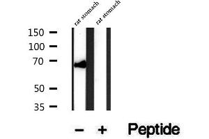 Image no. 1 for anti-Synovial Apoptosis Inhibitor 1, Synoviolin (SYVN1) (Internal Region) antibody (ABIN6265416)