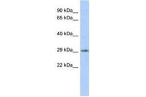 Image no. 1 for anti-Distal-Less Homeobox Protein 1 (DLX1) (N-Term) antibody (ABIN6742936)