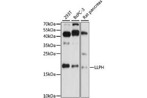 Image no. 1 for anti-LLP Homolog, Long-Term Synaptic Facilitation (Aplysia) (LLPH) antibody (ABIN6294073)