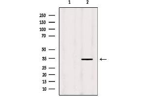 anti-Mitochondrial Ribosomal Protein L19 (MRPL19) (Internal Region) antibody
