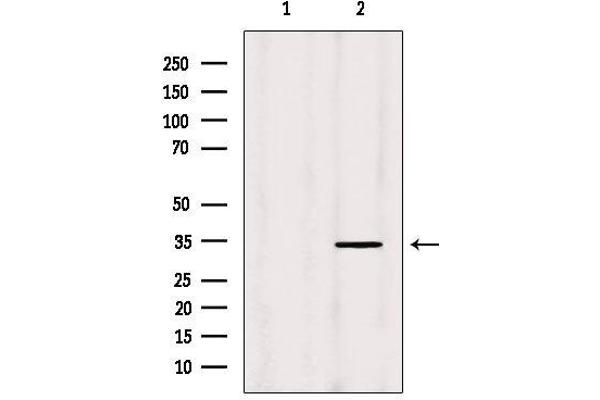 anti-Mitochondrial Ribosomal Protein L19 (MRPL19) (Internal Region) antibody
