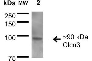 Image no. 2 for anti-Chloride Channel 3 (CLCN3) (AA 98-115) antibody (Alkaline Phosphatase (AP)) (ABIN2485478)