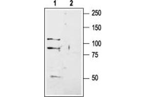 GRIK1 Antikörper  (Extracellular, N-Term)