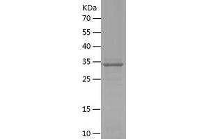SGCE Protein (AA 15-127) (His-IF2DI Tag)