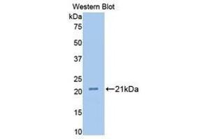 anti-Fibulin 1 (FBLN1) (AA 347-521) antibody