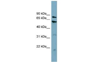CPT1B antibody  (Middle Region)