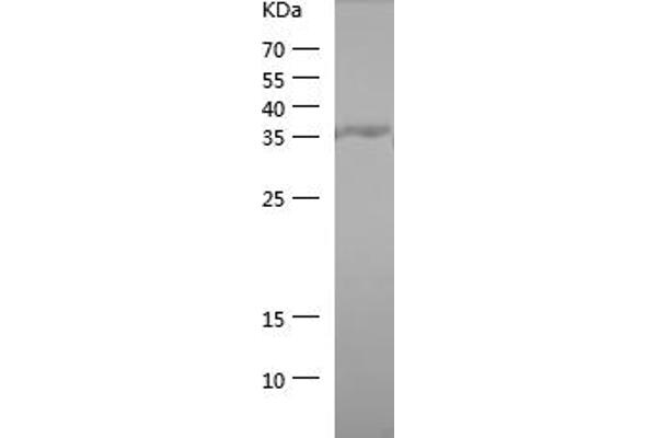 PTPN1 Protein (AA 268-406) (His tag)
