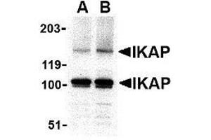Image no. 2 for anti-Elongator Complex Protein 1 (ELP1) (C-Term) antibody (ABIN499964)