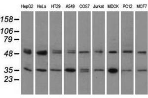 Image no. 3 for anti-Protein Kinase, CAMP-Dependent, Regulatory, Type II, alpha (PRKAR2A) antibody (ABIN2729600)