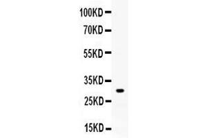 Image no. 3 for anti-ZW10 Interactor (ZWINT) (AA 29-249) antibody (ABIN4886776)
