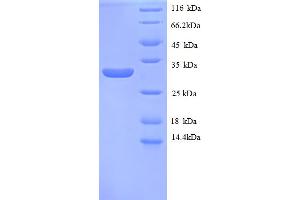 MT1E Protein (AA 4-59, partial) (GST tag)