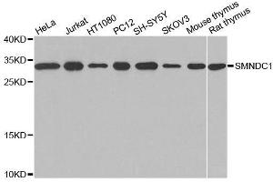 Image no. 2 for anti-Survival Motor Neuron Domain Containing 1 (SMNDC1) antibody (ABIN3021063)