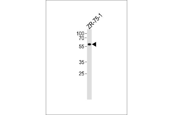 PPP2R2A Antikörper  (N-Term)