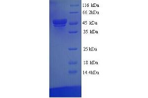 Image no. 1 for TEA Domain Family Member 1 (SV40 Transcriptional Enhancer Factor) (TEAD1) (AA 1-426), (full length) protein (His tag) (ABIN5713882)
