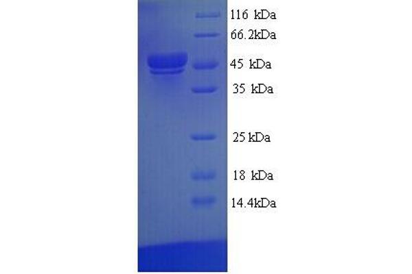 TEA Domain Family Member 1 (SV40 Transcriptional Enhancer Factor) (TEAD1) (AA 1-426), (full length) protein (His tag)