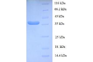 Image no. 1 for General Transcription Factor IIE, Polypeptide 2 (GTF2E2) (AA 1-291), (full length) protein (His tag) (ABIN5709625)