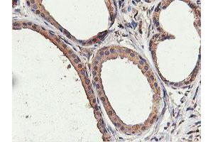 Image no. 6 for anti-IlvB (Bacterial Acetolactate Synthase)-Like (ILVBL) antibody (ABIN1498878)