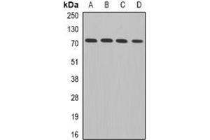Image no. 1 for anti-ADAM Metallopeptidase Domain 33 (ADAM33) (full length) antibody (ABIN6043124)