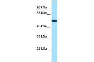 Image no. 1 for anti-ARP6 Actin-Related Protein 6 Homolog (ACTR6) (C-Term) antibody (ABIN2790716)