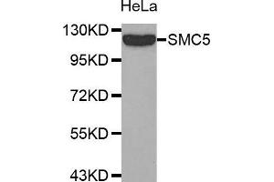 Image no. 1 for anti-Structural Maintenance of Chromosomes 5 (SMC5) antibody (ABIN1682829)