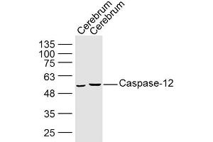 Image no. 4 for anti-Caspase 12 (Gene/pseudogene) (CASP12) (AA 201-300) antibody (ABIN737736)