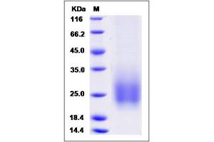 Image no. 1 for Tetraspanin 7 (TSPAN7) (AA 113-213) protein (His tag) (ABIN2008376)
