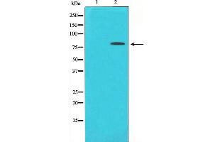 Image no. 4 for anti-Protein Kinase C, delta (PKCd) (pTyr313) antibody (ABIN6255881)