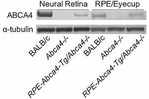 Image no. 3 for anti-ATP-Binding Cassette, Sub-Family A (ABC1), Member 4 (ABCA4) (AA 2250-2263) antibody (ABIN343052)