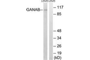 Image no. 1 for anti-Glucosidase, Alpha, Neutral AB (GANAB) (AA 242-291) antibody (ABIN1535109)