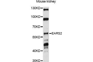 Image no. 1 for anti-Glutamyl-tRNA Synthetase 2 Mitochondrial (EARS2) antibody (ABIN6293105)