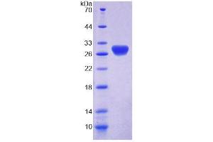 Image no. 1 for Retbindin (RTBDN) (AA 32-247) protein (His tag) (ABIN6238729)
