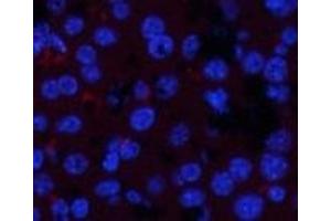 Immunofluorescence analysis of Mouse liver tissue with Phospho-JAK1 (Tyr1022) Polyclonal Antibody at dilution of 1:200