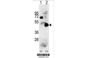 Image no. 2 for anti-Pyruvate Dehydrogenase Kinase, Isozyme 4 (PDK4) (AA 382-410), (C-Term) antibody (ABIN391039)