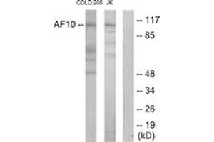 Image no. 1 for anti-Protein AF-10 (MLLT10) (AA 211-260) antibody (ABIN1533784)