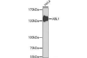 Western blot analysis of extracts of HeLa cells using ABL1 Polyclonal Antibody at dilution of 1:1000.