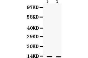 Image no. 2 for anti-S100 Calcium Binding Protein A9 (S100A9) (AA 2-114) antibody (ABIN3043321)