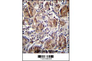 Immunohistochemistry (IHC) image for anti-CTD Nuclear Envelope Phosphatase 1a (CTDNEP1A) (Center) antibody (ABIN2160726)