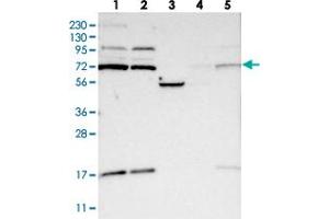 Image no. 2 for anti-Kelch-Like 6 (KLHL6) antibody (ABIN5581990)