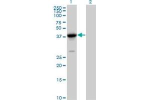 Image no. 1 for anti-Fanconi Anemia, Complementation Group L (FANCL) (AA 1-375) antibody (ABIN527357)