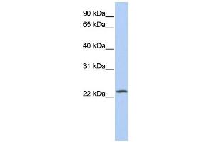 anti-Phosphatidylinositol-4-Phosphate 5-Kinase-Like 1 (PIP5KL1) (Middle Region) antibody