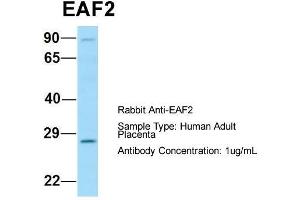 Image no. 1 for anti-ELL Associated Factor 2 (EAF2) (C-Term) antibody (ABIN2789956)