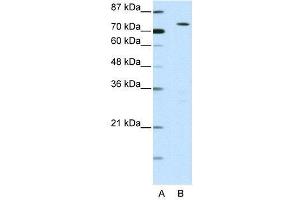 Image no. 2 for anti-MYST Histone Acetyltransferase 2 (MYST2) (N-Term) antibody (ABIN2777626)