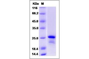 Image no. 1 for Core-Binding Factor, beta Subunit (CBFB) (AA 1-182), (Mature) protein (His tag) (ABIN2006272)