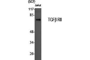 Western Blot analysis of Jurkat cells using TGF β Receptor II Polyclonal Antibody at dilution of 1:2000.