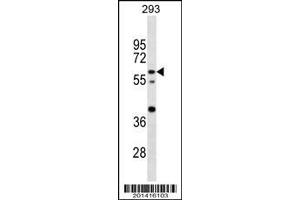 Western Blotting (WB) image for anti-CCR4-NOT Transcription Complex Subunit 4 (CNOT4) antibody (ABIN2160204)