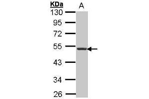 anti-Chemokine (C-X-C Motif) Receptor 5 (CXCR5) (Internal Region) antibody