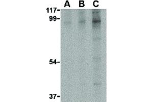 Image no. 1 for anti-BR serine/threonine Kinase 2 (BRSK2) (C-Term) antibody (ABIN6655970)