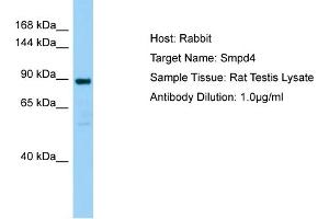 Image no. 1 for anti-Sphingomyelin Phosphodiesterase 4 (SMPD4) (Middle Region) antibody (ABIN2782934)
