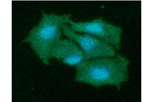 Image no. 2 for anti-Killer Cell Immunoglobulin-Like Receptor, Two Domains, Long Cytoplasmic Tail, 1 (KIR2DL1) antibody (ABIN165422)